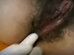 Doctor Removes Bandages To Real Her Unshaved Arse And Fucks It